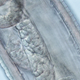 A close-up of a Thelazia gulosa worm taken out of Abby Beckley’s eye. Photo: CDC Global